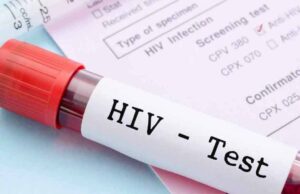 HIV रिपोर्ट्स से हटेंगे पहचान चिन्ह, गोपनीयता सुनिश्चित करने को नई व्यवस्था लागू