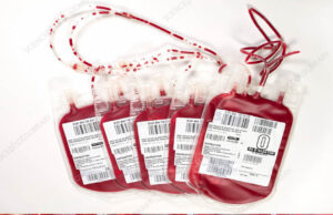 हजार लीटर बकरी का खून इंसानी ब्लड बैग में पाया गया, रेड से खुला बड़ा मामला; कहां का है ये घटना?