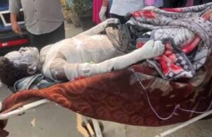 मंगल कार्बन प्लांट हादसा: जोरदार विस्फोट में 9 माह का बच्चा समेत 8 मजदूर गंभीर रूप से घायल