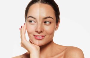 झुलसी त्वचा से छुटकारा: घर बैठे अपनाएँ ये 5 असरदार उपाय