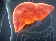 Fatty Liver Alert: AIIMS डॉक्टर बोले- तुरंत छोड़ दें ये 4 चीजें, शराब जितना पहुंचाती हैं लिवर को नुकसान