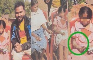 पत्थर जैसी बन रही बच्ची का होगा इलाज, बाल आयोग ने मामले में दिखाई सक्रियता