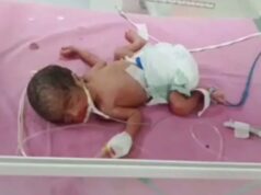 राजस्थान में दुर्लभ मामला, सिजेरियन से जन्मे तीन बेटियां और एक बेटा साथ