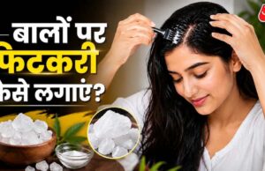 बारिश में बालों की देखभाल, फिटकरी से डैंड्रफ और खुजली से राहत