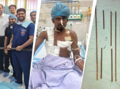 दर्दनाक हादसे के बाद मेडिकल चमत्कार, शरीर में धंसे 4 सरियों को KGMU के डॉक्टरों ने सफल ऑपरेशन से निकाला